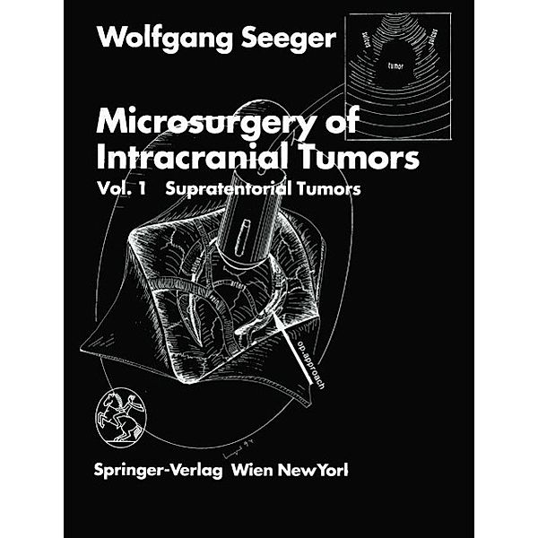 Microsurgery of Intracranial Tumors, Wolfgang Seeger