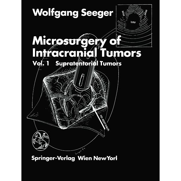 Microsurgery of Intracranial Tumors, Wolfgang Seeger