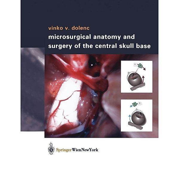 Microsurgical Anatomy and Surgery of the Central Skull Base, Vinko V. Dolenc