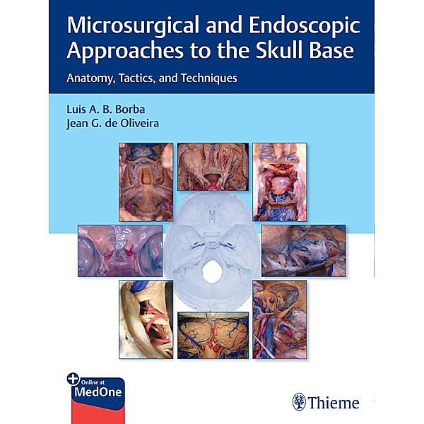 Microsurgical and Endoscopic Approaches to the Skull Base, Luis Borba, Jean de Oliveira