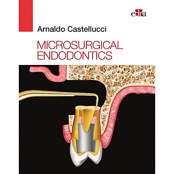 Microsurgical Endodontics, Arnaldo Castellucci