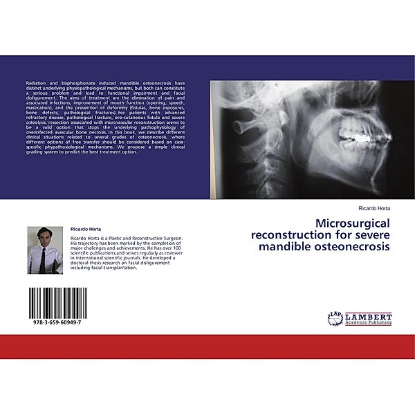 Microsurgical reconstruction for severe mandible osteonecrosis, Ricardo Horta