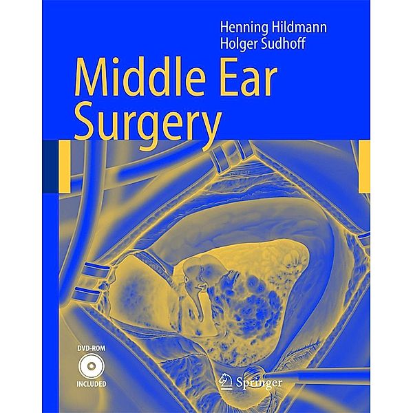 Middle Ear Surgery, Henning Hildmann, Holger Sudhoff