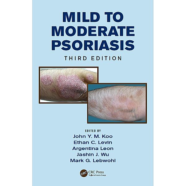 Mild to Moderate Psoriasis