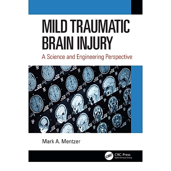 Mild Traumatic Brain Injury, Mark A. Mentzer