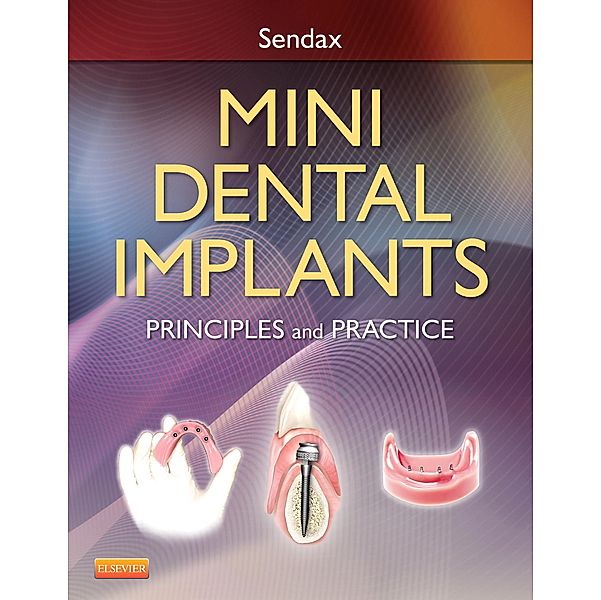 Mini Dental Implants, Victor Sendax