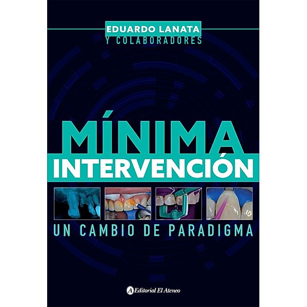 Mínima intervención, Eduardo Lanata