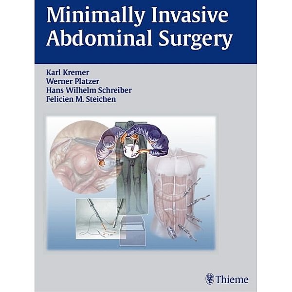 Minimally Invasive Abdominal Surgery