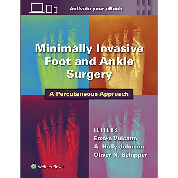 Minimally Invasive Foot and Ankle Surgery, Ettore Vulcano, Holly Johnson, Oliver Schipper