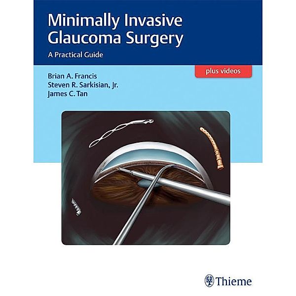 Minimally Invasive Glaucoma Surgery, Brian Francis, Steven Sarkisian, James C. Tan