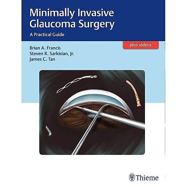 Minimally Invasive Glaucoma Surgery, Brian Francis, Steven Sarkisian, James C. Tan