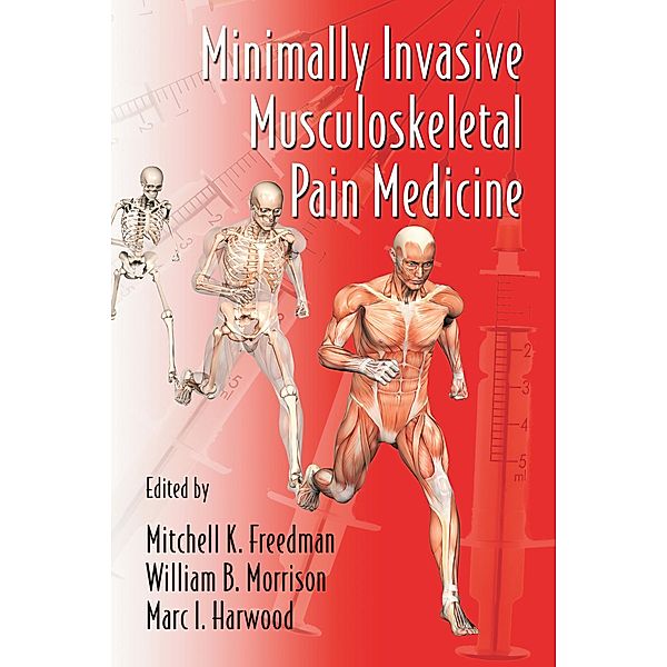 Minimally Invasive Musculoskeletal Pain Medicine