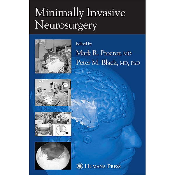 Minimally Invasive Neurosurgery