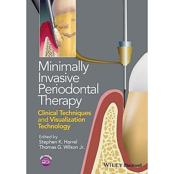 Minimally Invasive Periodontal Therapy, Stephen K. Harrel, Thomas G. Wilson
