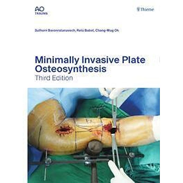 Minimally Invasive Plate Osteosynthesis, Suthorn Bavonratanavech, Reto Babst, Chang-Wug OH