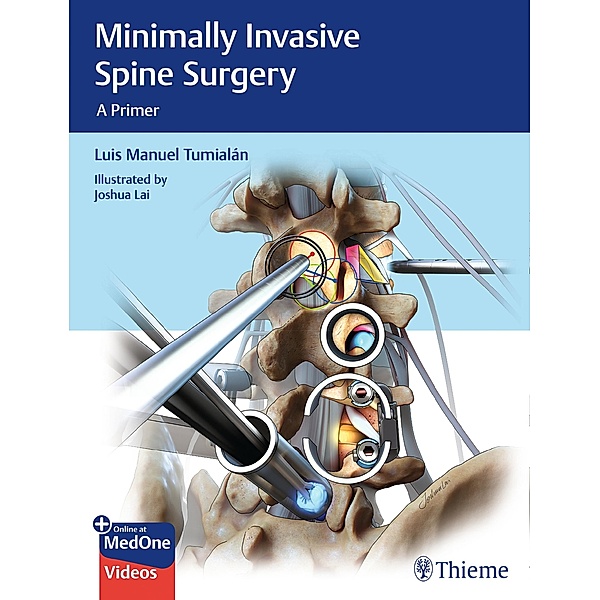 Minimally Invasive Spine Surgery, Luis Manuel Tumialan