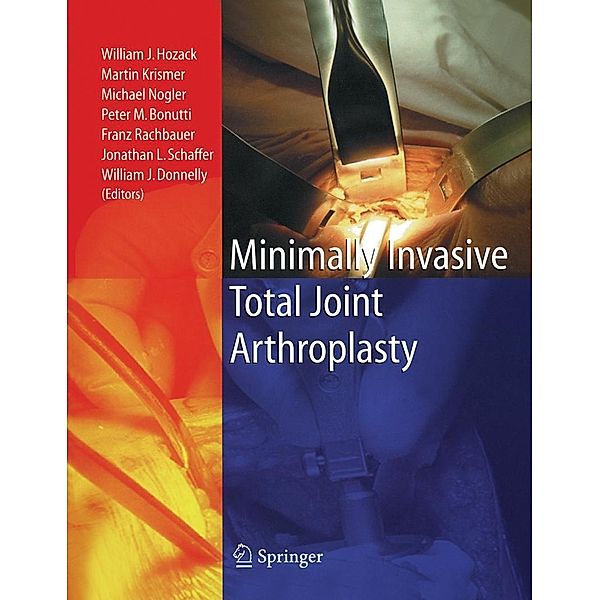 Minimally Invasive Total Joint Arthroplasty