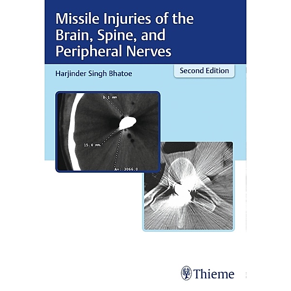 Missile Injuries of the Brain, Spine, and Peripheral Nerves, Harjinder Singh Bhatoe
