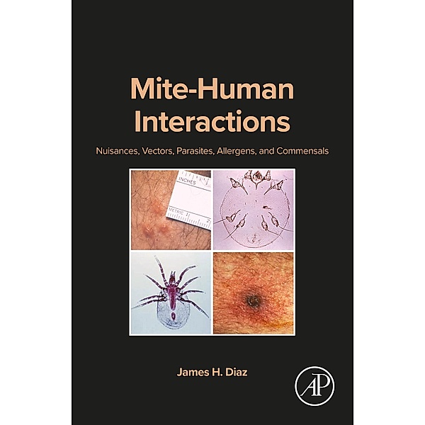 Mite-Human Interactions, James H. Diaz