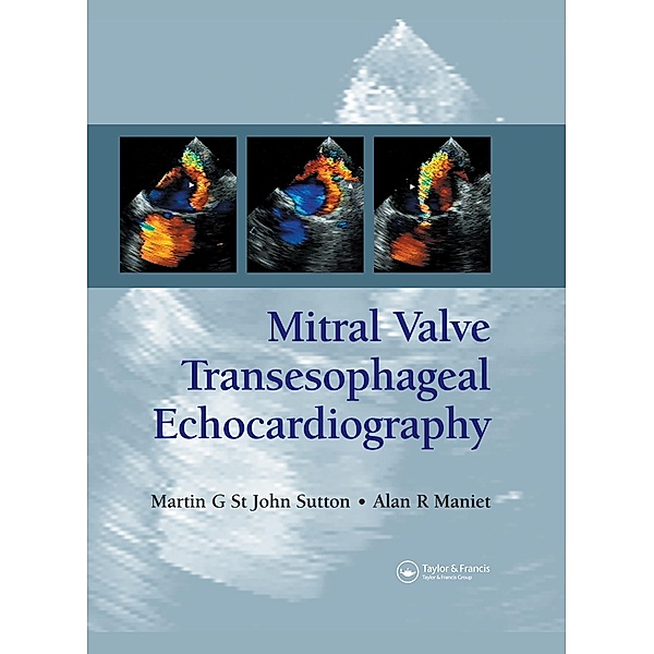 Mitral Valve Transesophageal Echocardiography, Martin G. St. John Sutton, Alan R. Maniet