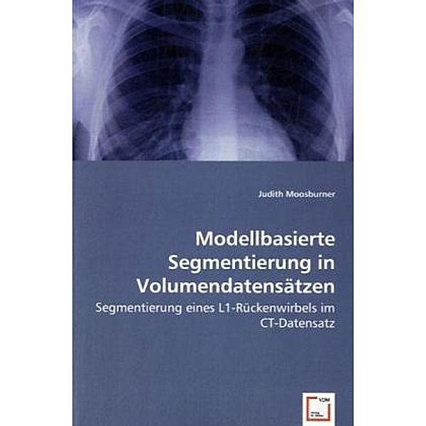 Modellbasierte Segmentierung in Volumendatensätzen, Judith Moosburner