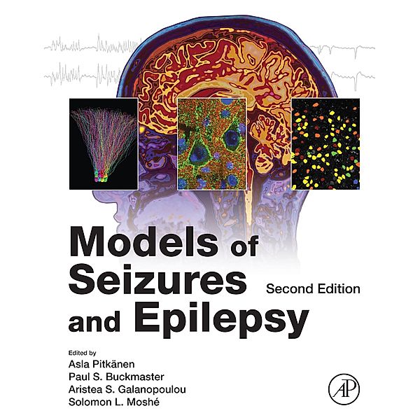Models of Seizures and Epilepsy