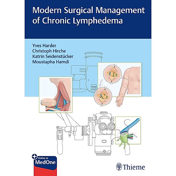 Modern Surgical Management of Chronic Lymphedema