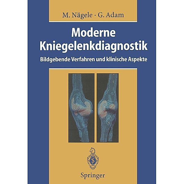 Moderne Kniegelenkdiagnostik, Matthias Nägele, Gerhard Adam