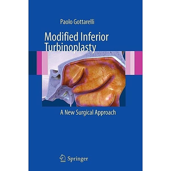 Modified Inferior Turbinoplasty, Paolo Gottarelli