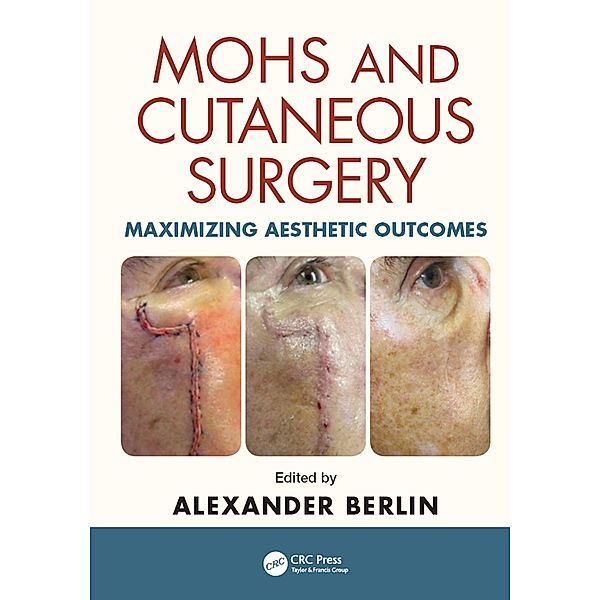 Mohs and Cutaneous Surgery