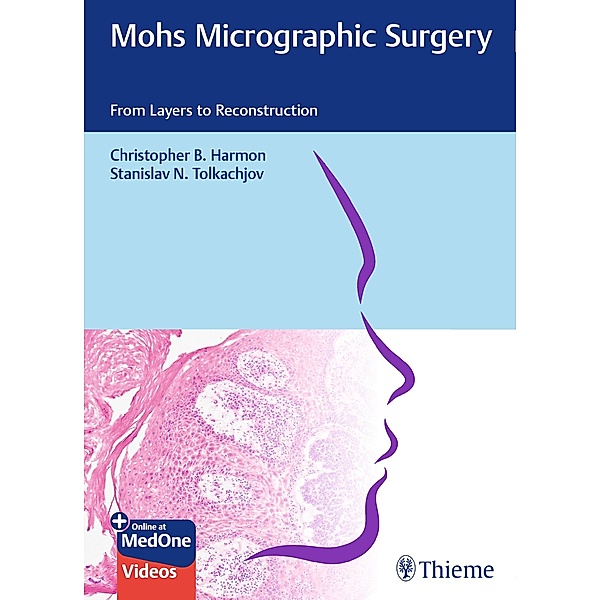 Mohs Micrographic Surgery: From Layers to Reconstruction, Christopher B. Harmon, Stanislav N. Tolkachjov