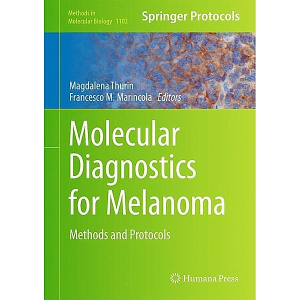 Molecular Diagnostics for Melanoma
