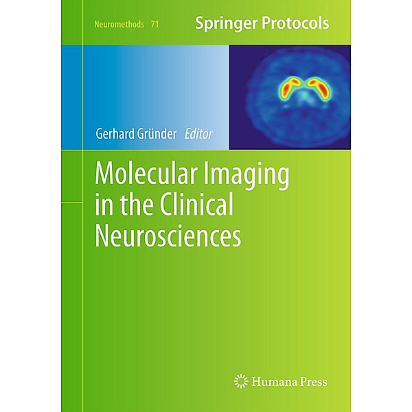 Molecular Imaging in the Clinical Neurosciences