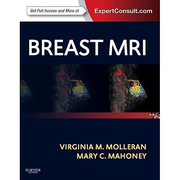 Molleran, V: Breast MRI, Virginia Molleran, Mary C. Mahoney