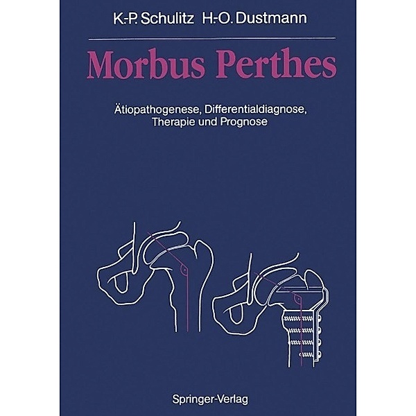 Morbus Perthes, Klaus-Peter Schulitz, Hans-Otto Dustmann