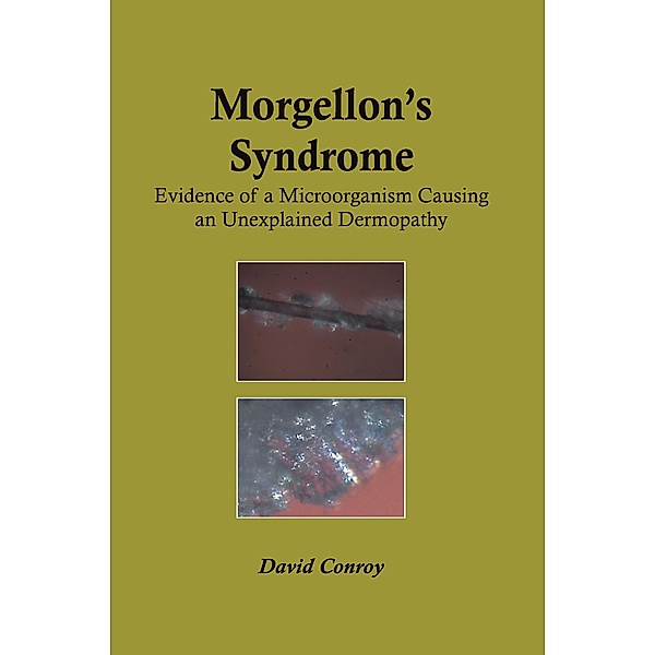 Morgellon's Syndrome, David Conroy