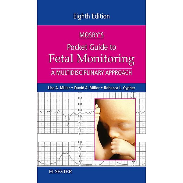 Mosby's Pocket Guide to Fetal Monitoring - E-Book, Lisa A. Miller, David Miller, Rebecca L. Cypher