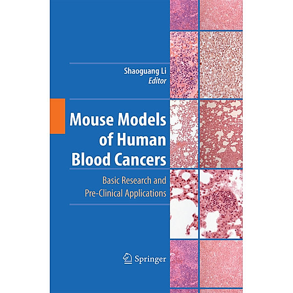 Mouse Models of Human Blood Cancers