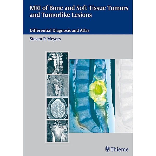 MR Imagaging of Bone and Soft Tissue Tumors Tumor-like Lesions, Steven P. Meyers