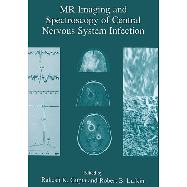 MR Imaging and Spectroscopy of Central Nervous System Infection