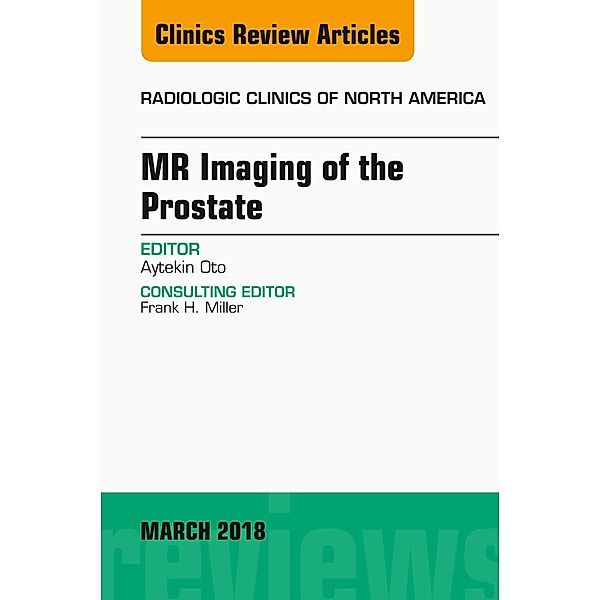 MR Imaging of the Prostate, An Issue of Radiologic Clinics of North America, Aytekin Oto