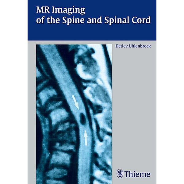 MR Imaging of the Spine and Spinal Cord, Detlev Uhlenbrock