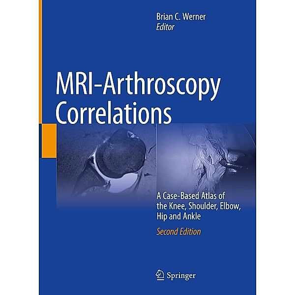 MRI-Arthroscopy Correlations