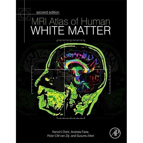 MRI Atlas of Human White Matter, Peter C M van Zijl, Susumu Mori