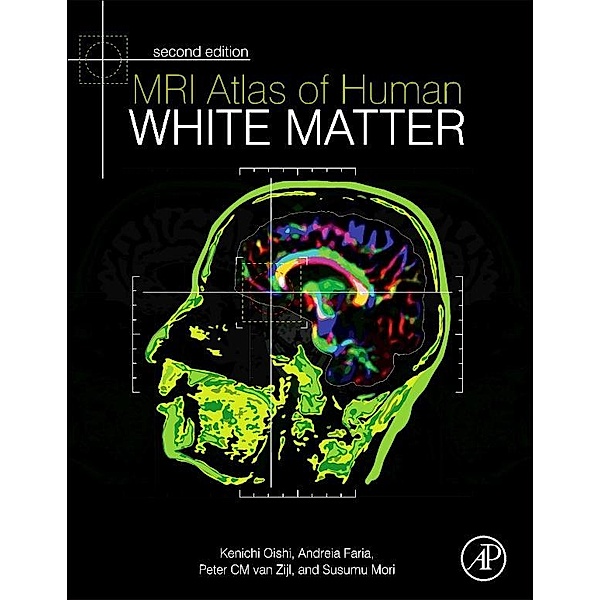 MRI Atlas of Human White Matter, Kenichi Oishi, Andreia V. Faria, Peter C M van Zijl, Susumu Mori