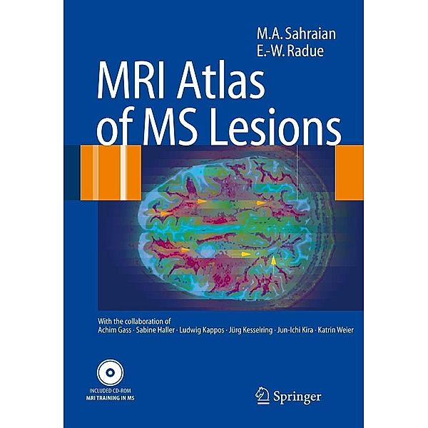 MRI Atlas of MS Lesions, M. A. Sahraian, Ernst-Wilhelm Radü