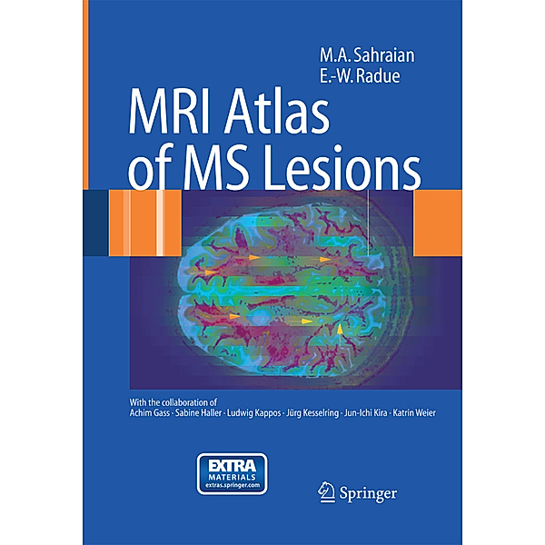 MRI Atlas of MS Lesions, M. A. Sahraian, Ernst-Wilhelm Radü