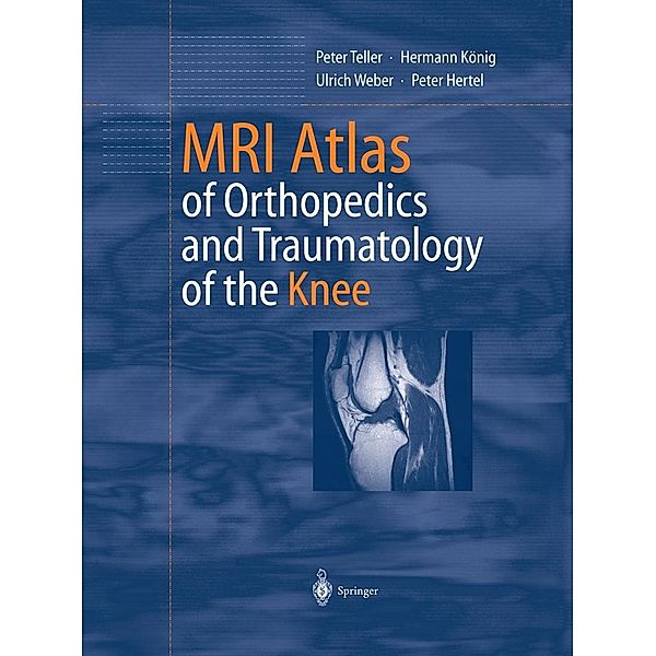MRI Atlas of Orthopedics and Traumatology of the Knee, Peter Teller, Hermann König, Ulrich Weber, Peter Hertel
