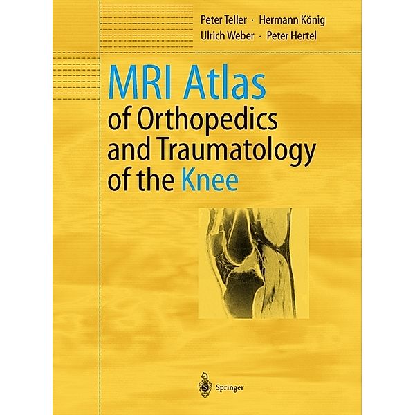 MRI Atlas of Orthopedics and Traumatology of the Knee, Peter Teller, Hermann König, Ulrich Weber, Peter Hertel