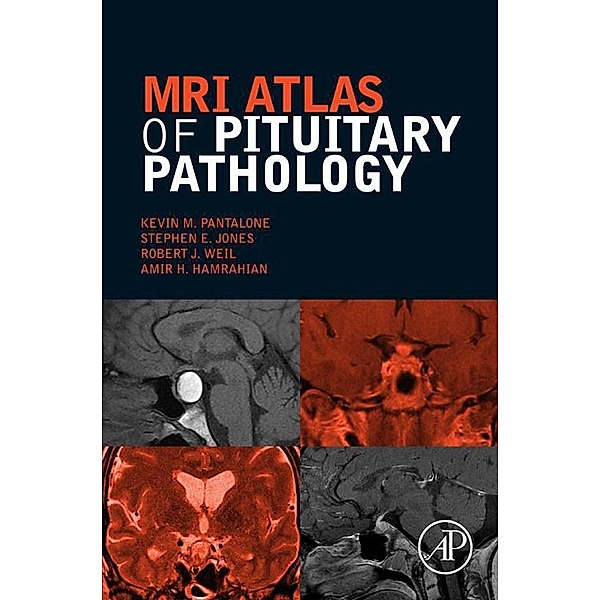 MRI Atlas of Pituitary Pathology, Kevin M. Pantalone, Stephen E. Jones, Robert J. Weil, Amir H. Hamrahian